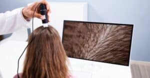 The Best Hair Thinning Treatment for Female Patients