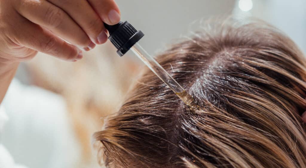 Female Hair Regrowth Treatment Options