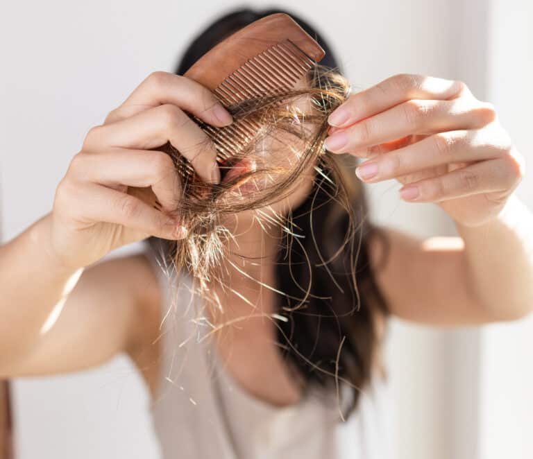 Extreme Hair Fall in Women