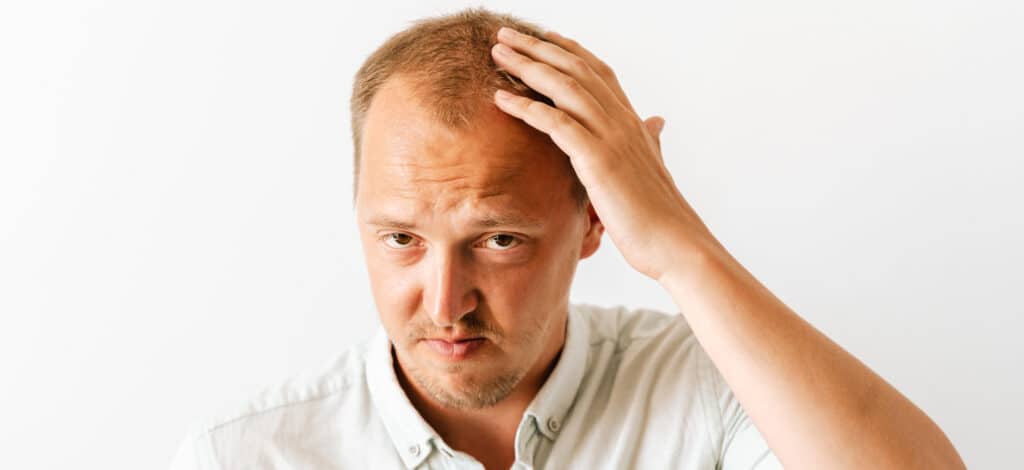 itchy scalp and hair loss in men