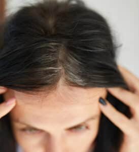 10 Powerful Tips to Manage Thinning Hair Perimenopause