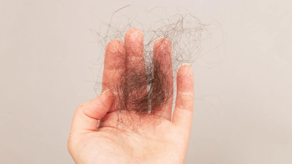 Excessive Hair Shedding Female Overview and Proven Tips