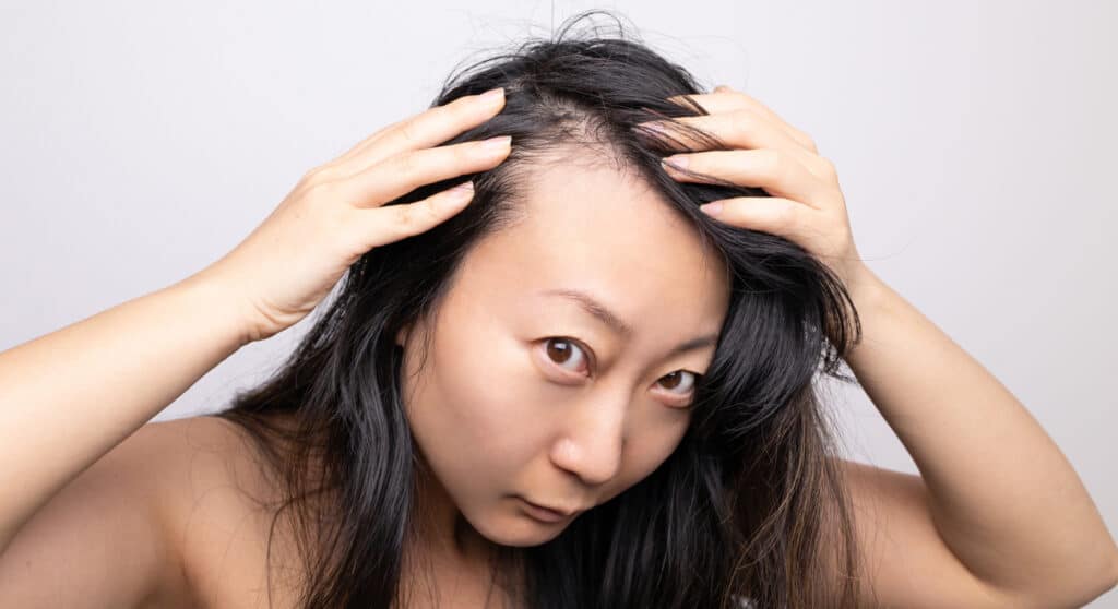 Hair Loss Causes and Powerful Female Hair Loss Solutions