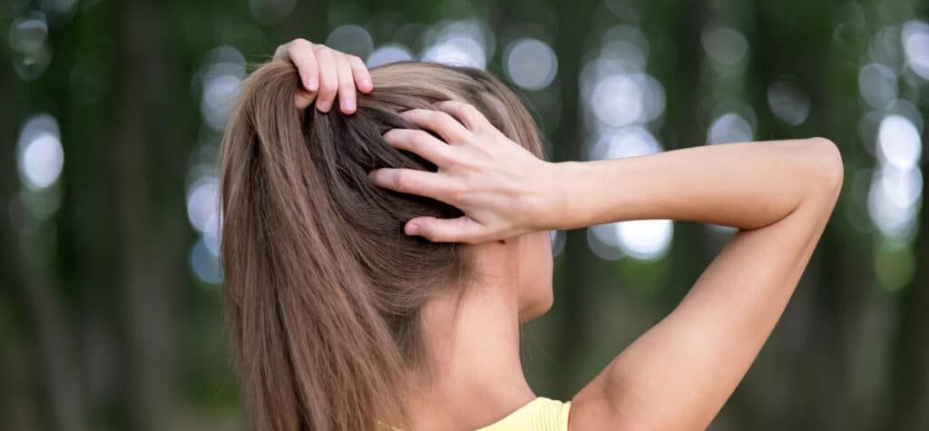 Powerful Remedies for Hair Thinning at Back of Head Female