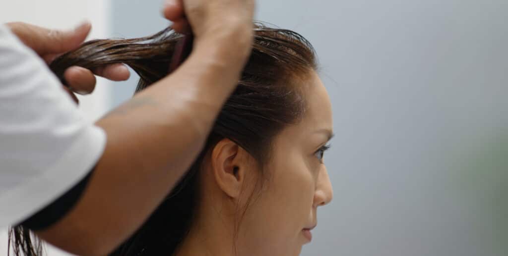 receding hairline women Empowering Solutions for Beautiful Results